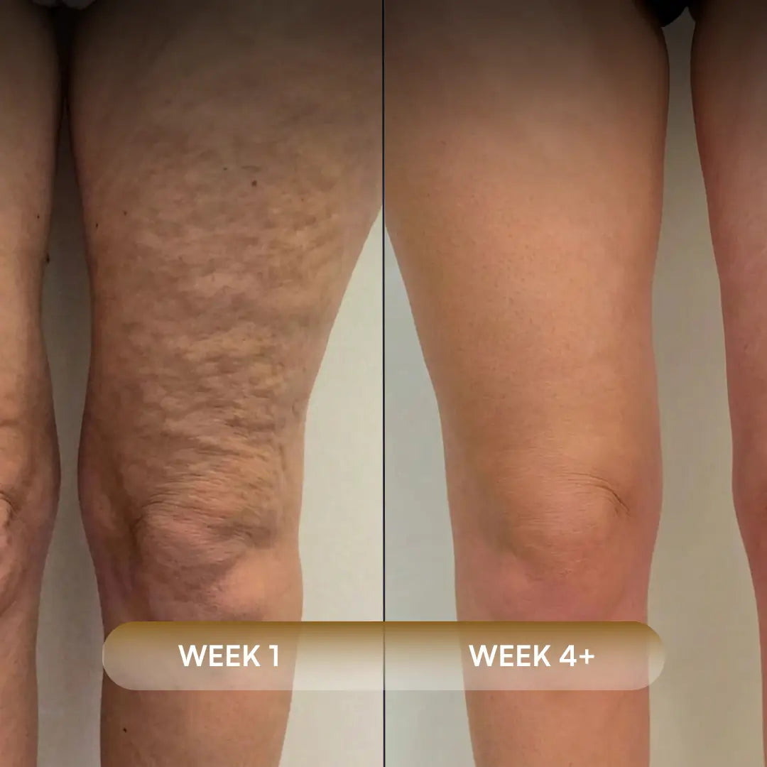 Anti-Cellulite Massage Oil