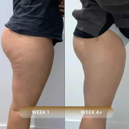 Anti-Cellulite Massage Oil
