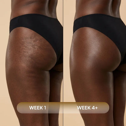 Anti-Cellulite Massage Oil